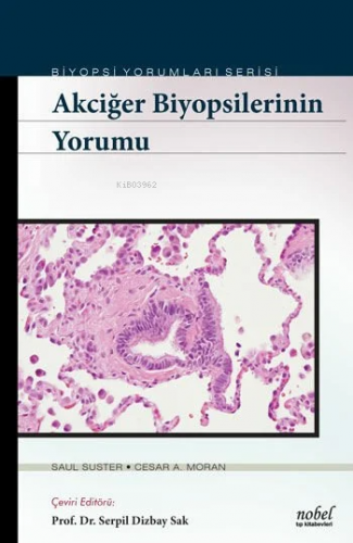 Akciğer Biyopsilerinin Yorumu - Biyopsi Yorumları Serisi - Kitapiks.co