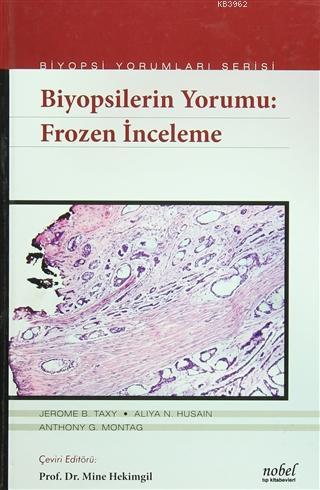 Biyopsilerin Yorumu: Frozen İnceleme - Kitapiks.com