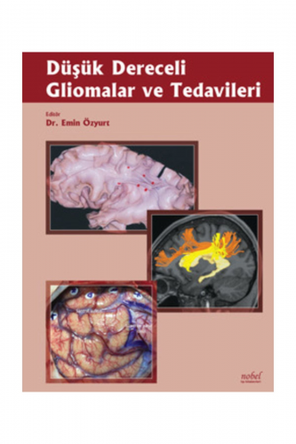 Düşük Dereceli Gliomalar Ve Tedavileri - Kitapiks.com