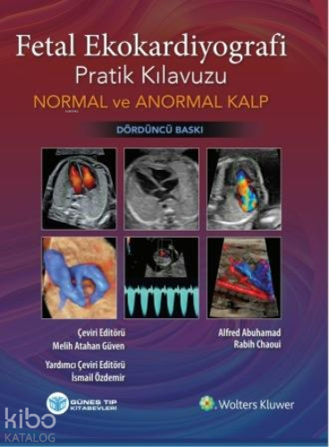 Fetal Ekokardiyografi Pratik Kılavuzu Normal ve Anormal Kalp - Kitapik