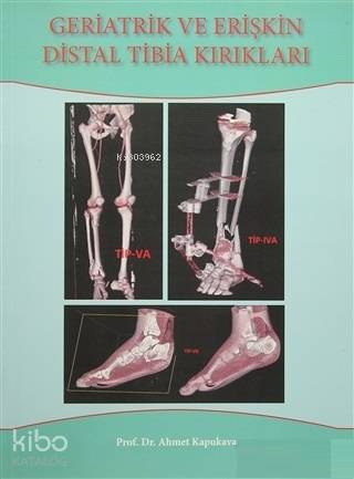 Geriatrik Ve Erişkin Distal Tibia Kırıkları - Kitapiks.com