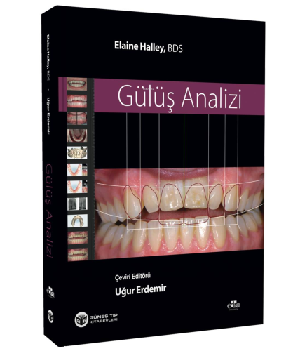 Gülüş Analizi