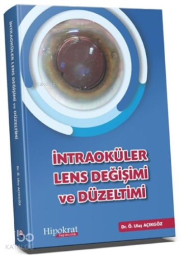 İntraoküler Lens Değişimi ve Düzeltimi - Kitapiks.com
