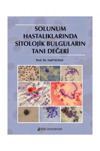 Solunum Hastalıklarında Sitolojik Bulguların Tanı Değeri - Kitapiks.co