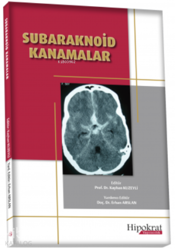 Subaraknoid Kanamalar - Kitapiks.com