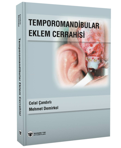 Temporomandibular Eklem Cerrahisi - Kitapiks.com
