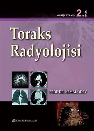 Toraks Radyolojisi - Kitapiks.com